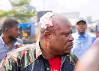 Kinshasa : Jean-Marc Kabund blessé lors d’une intervention politique perturbée au camp Luka